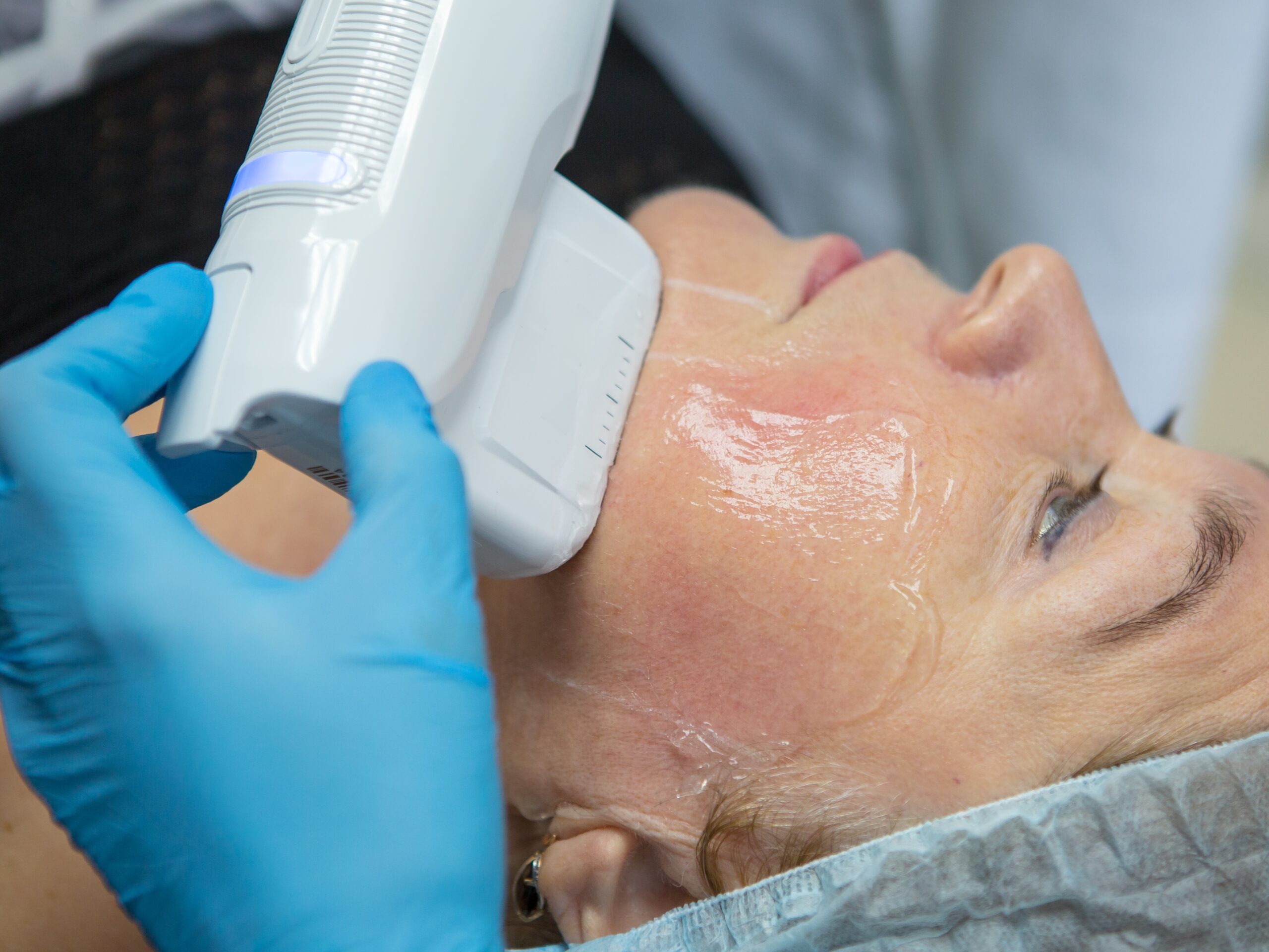 Importance of Hifu Treatment in KL & Malaysia